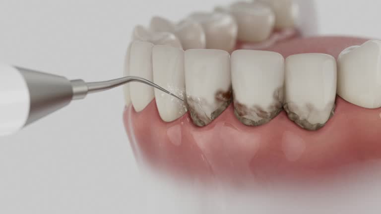Reliable Tooth Extraction contractor in Prince William County County, VA by Dentist Open Now